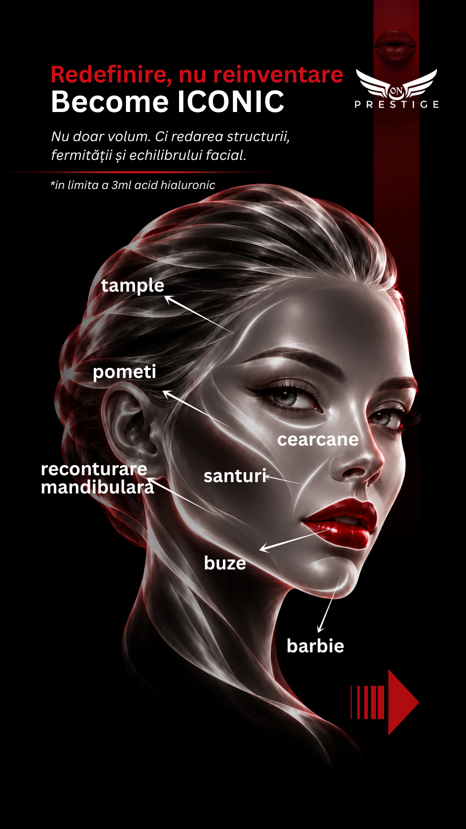 botox 3 zone