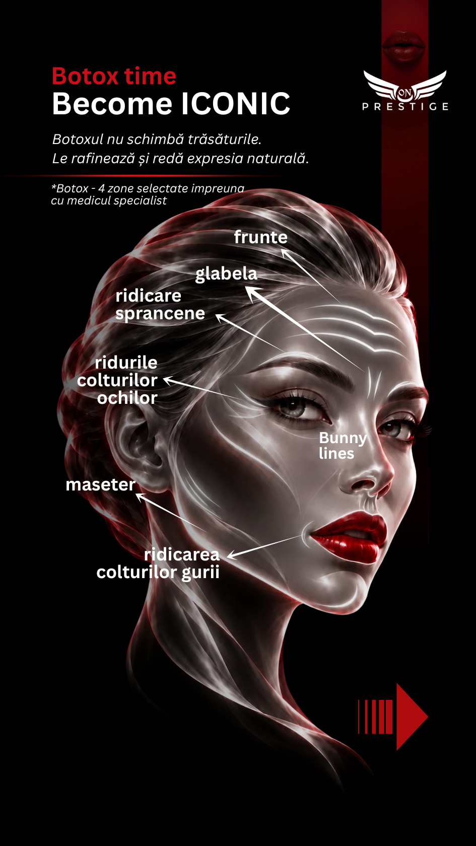 pret botox