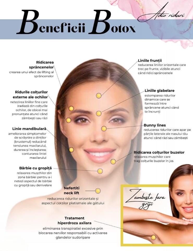 Zone injectare botox
