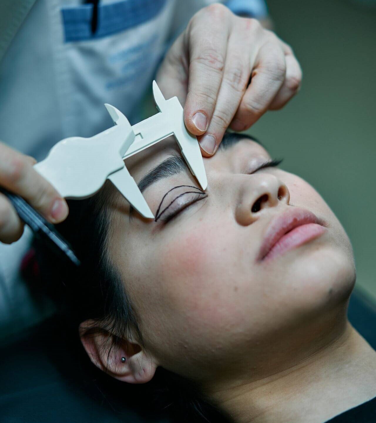 blefaroplastie