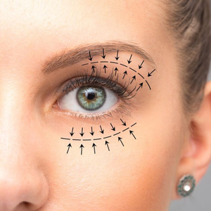 blegaroplastie totala Clinica Prestige