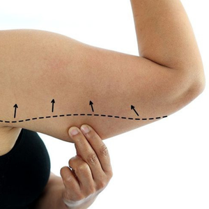 brahiplastie Clinica Prestige Bucuresti