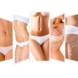 liposuctie Clinica Prestige Bucuresti