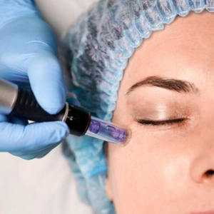 mezoterapie Clinica Prestige Bucuresti (2)