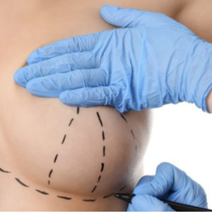 micsorare sani Clinica Prestige Bucuresti