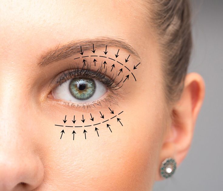 blefaroplastie totala bucuresti