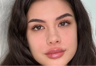 Clinica Prestige Bucuresti - acid hialuronic-1