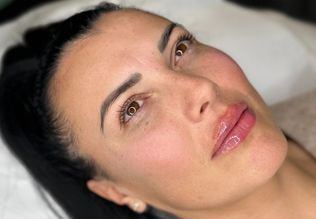 Clinica Prestige Bucuresti - buze perfecte-1