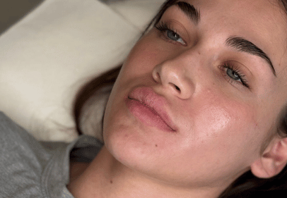 acid hialuronic revox cluj