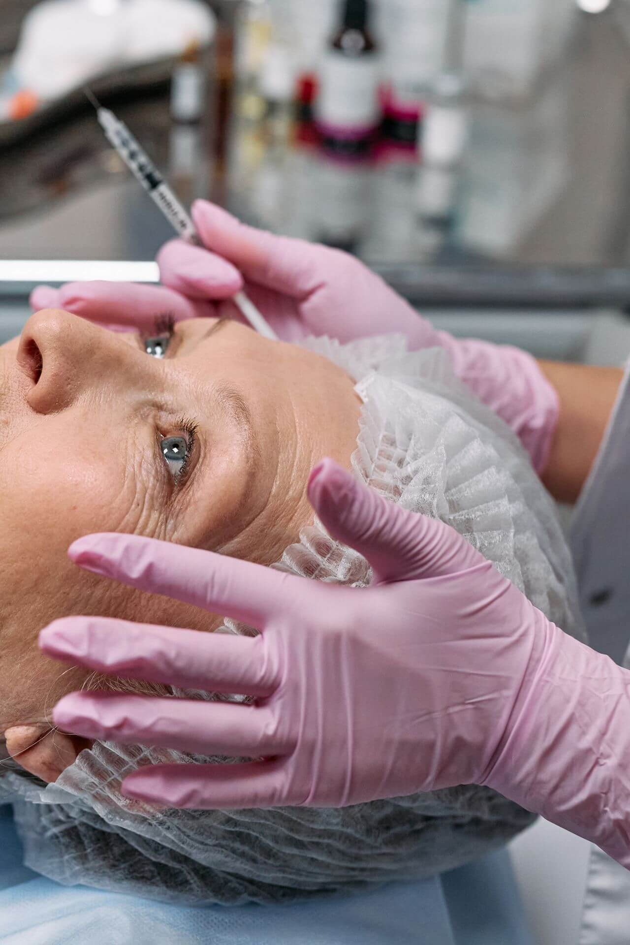 blefaroplastie 2
