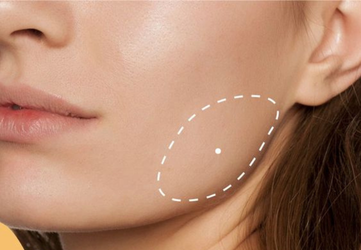 botox bruxism clinica prestige bucuresti