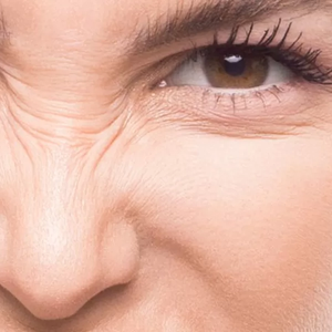 botox bucuresti