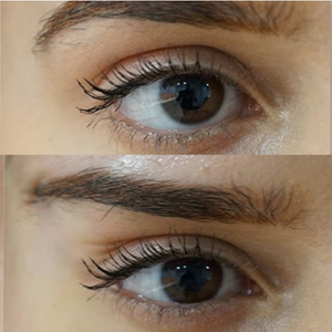 cantopexie bucuresti