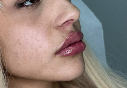 contur buze bucuresti