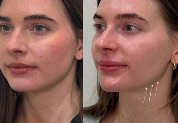 definire mandibulara clinica prestige-1