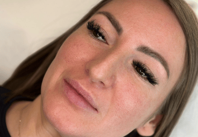 hyaluron pen bucuresti