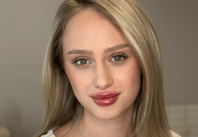 injectare acid hialuronic prestige timisoara