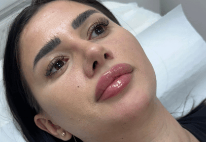 injectare acid hialuronic-Apr-14-2026-07-19-50-6210-PM