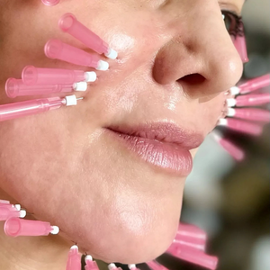 lifting facial cu fire pret cluj