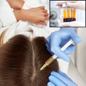 prp Clinica Prestige Bucuresti