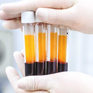 rejuvenare cu celule stem Clinica Prestige Bucuresti (2)