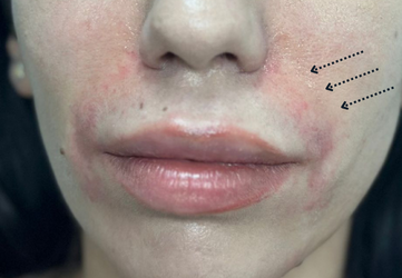 santuri nazogeniene clinica prestige cluj